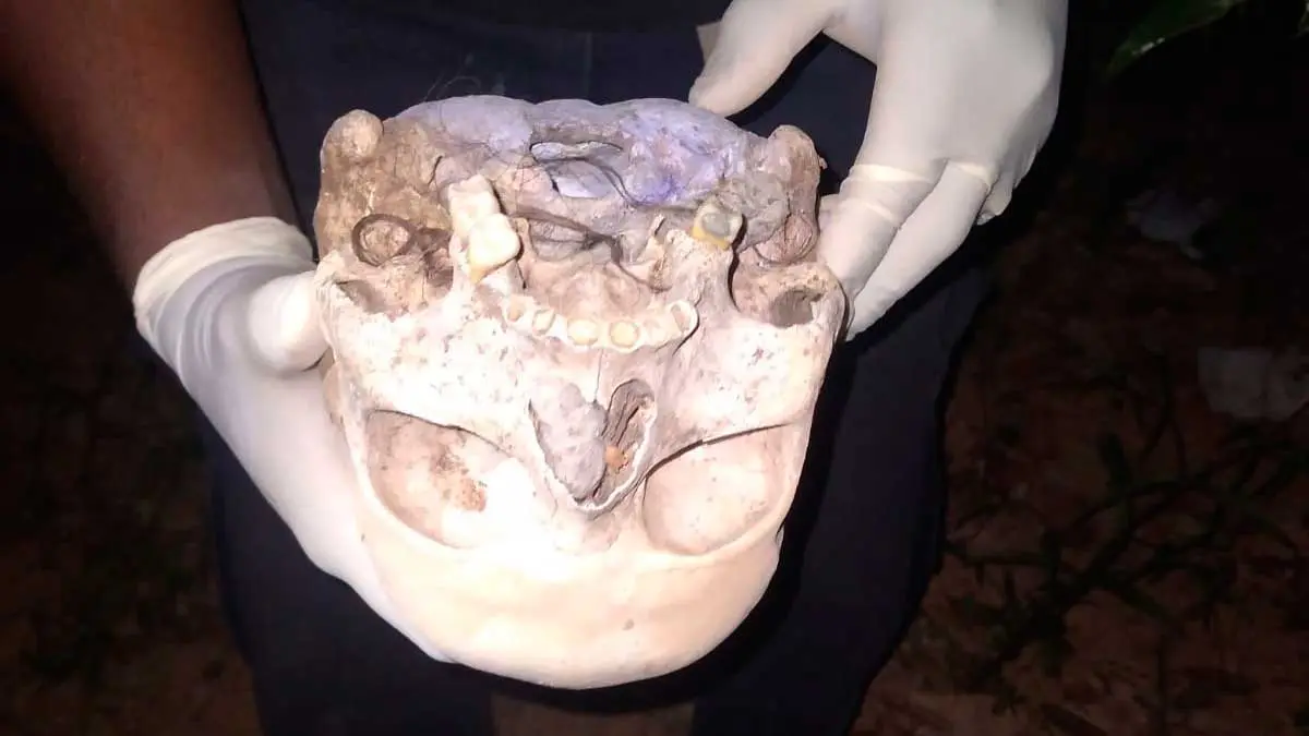Crânio humano é encontrado em Barreiras